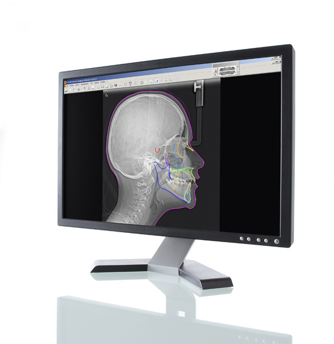 Das Röntgengerät Carestream 9300 liefert gestochen scharfe Bilder für eine noch bessere Diagnostik und Therapieplanung