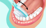 Richtig Zähneputzen bei Mundgeruch